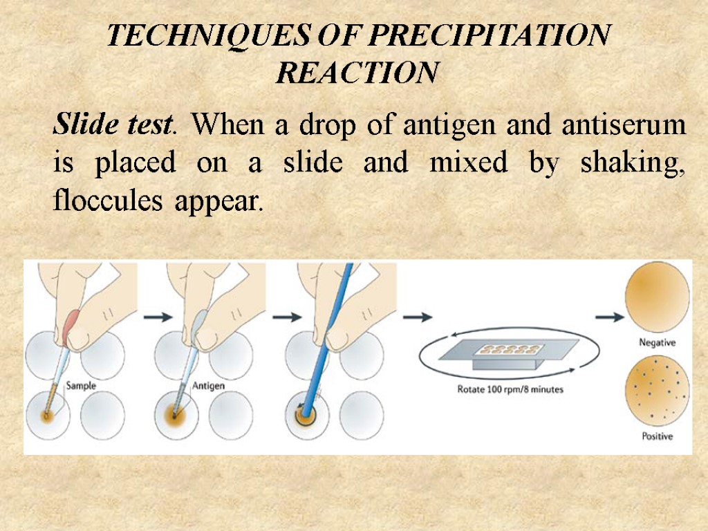 TECHNIQUES OF PRECIPITATION REACTION Slide test. When a drop of antigen and antiserum is